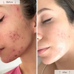 Online Omnilux Clear