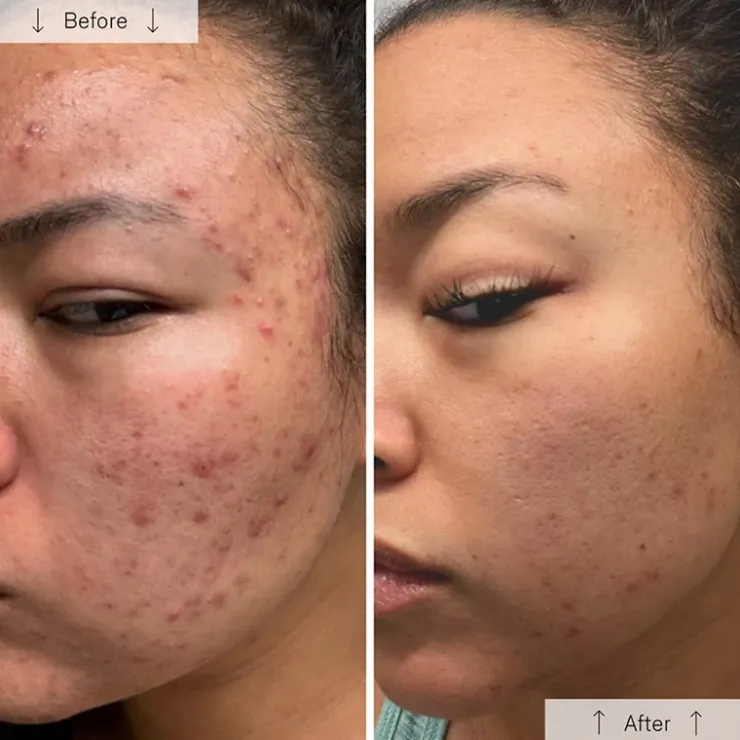 Online Omnilux Clear