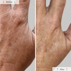 Best Omnilux Contour Glove