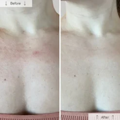 Fashion Omnilux Contour Neck & Décolleté